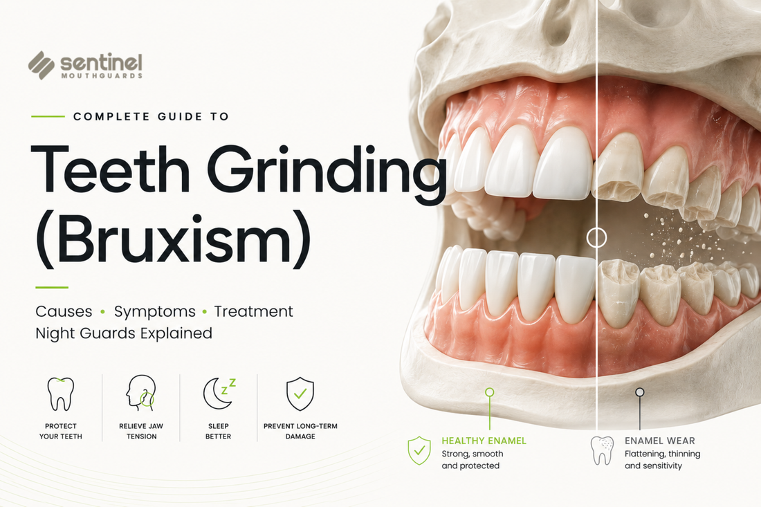 The Complete Guide to Teeth Grinding (Bruxism): Causes, Symptoms, Treatment & Night Guards