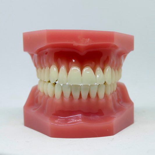 what is enamel erosion_what is teeth staining