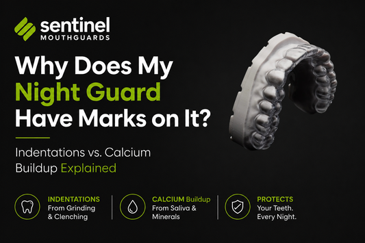 Why Does My Night Guard Have Marks on It? (Indentations vs. Calcium Buildup Explained)