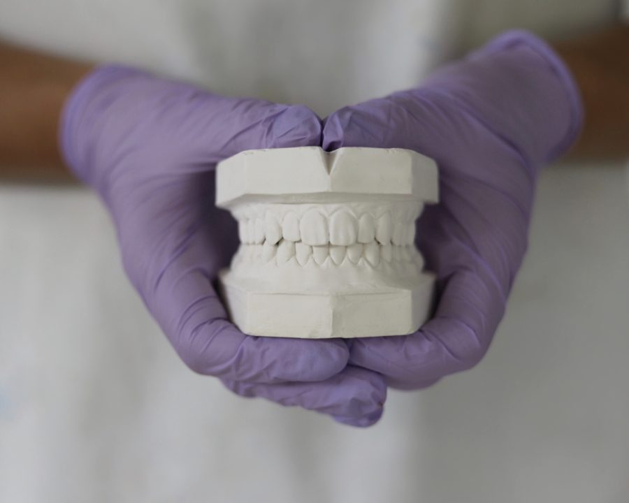 how to take a perfect dental impression
